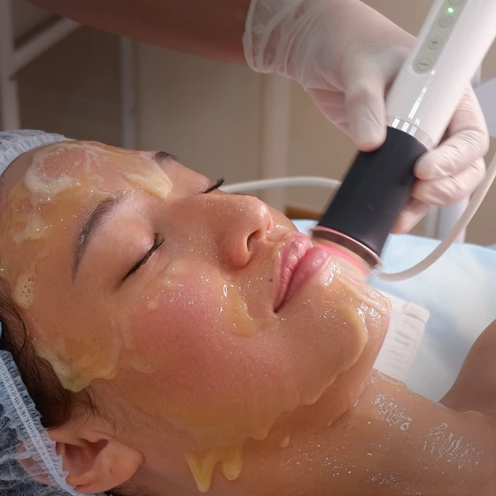 Medical Facial 04