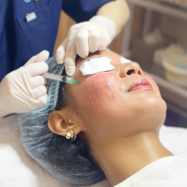 Face Contouring & Tightening 02
